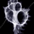 000236 Radiographie d'un murex endivia (Chicoreus cichoreum). Image noir et blanc.
