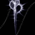000262 Radiographie d'un murex (Murex tribulus tenuirostrum). Image noir et blanc.