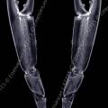 000266 Radiographie de pinces de langoustine (Nephrops norvegicus). Image noir et blanc.